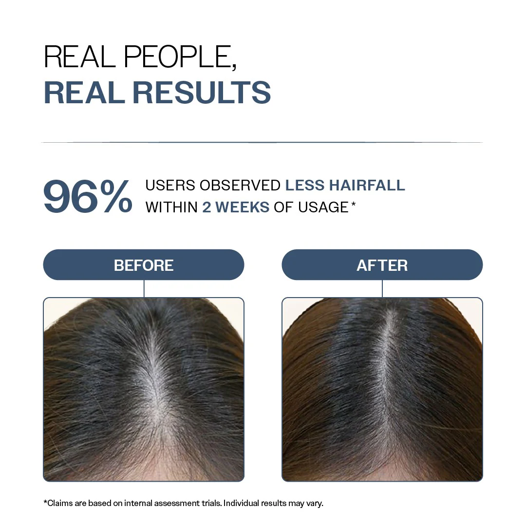 Hair Fall Control Shampoo with Peptides - 100 ml - Image 5
