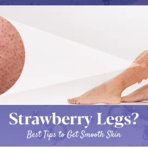 Strawberry Legs: Causes, Treatments & Tips to Prevent Them